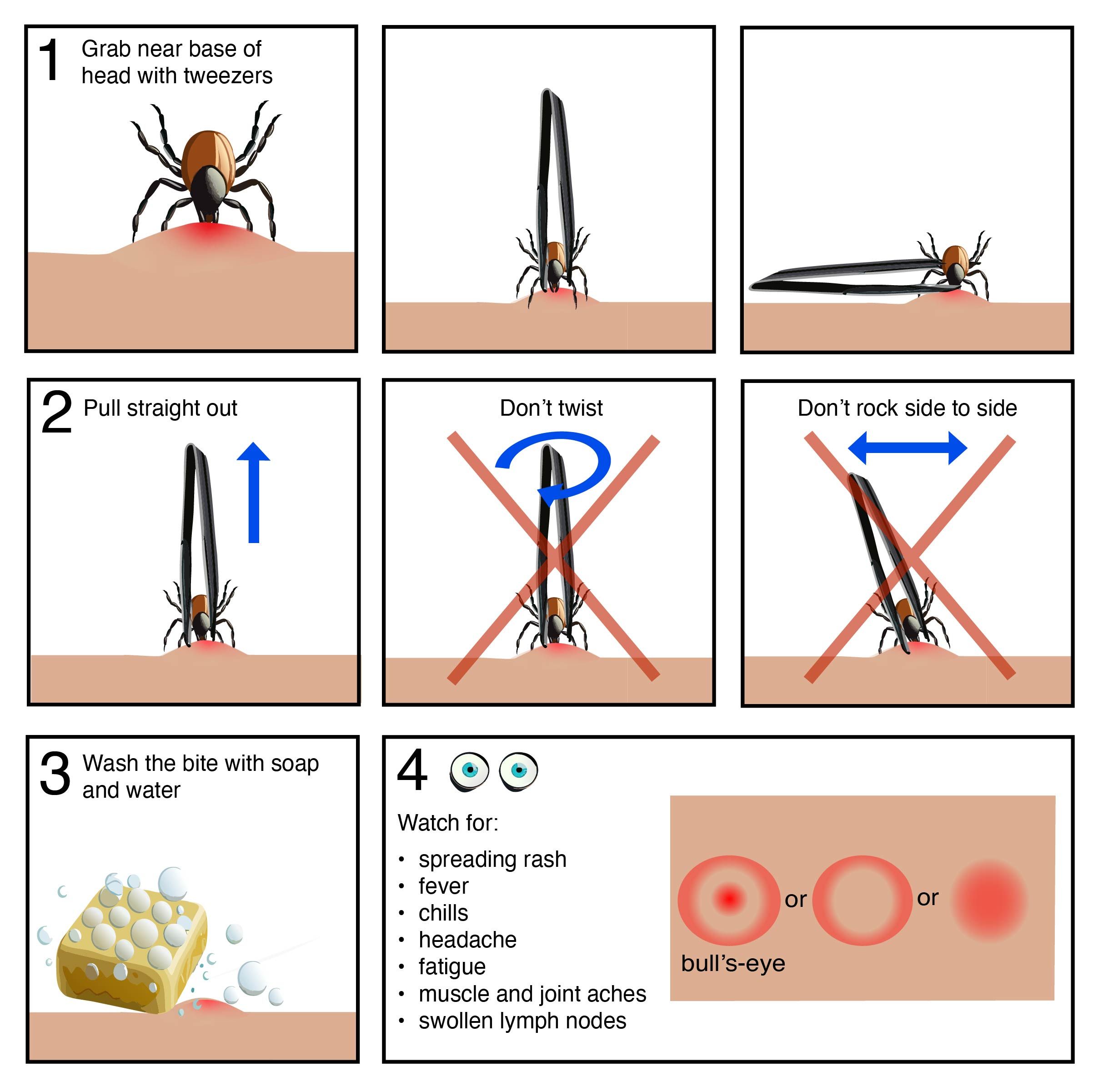 Infographic of proper steps for tick removal and monitoring.